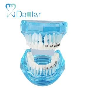 Modello Anatomico Dentale Ortodontico in Resina Plastica per Comunicazione Professionale con Pazienti - Product Image 2