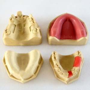 Giảng Dạy Nha Khoa Cấy Ghép Thực Hành Mô Hình - Product Image 2