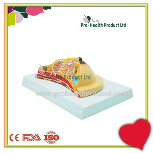 Modelo Anatômico de Doença de Lesão em Patologia Mamária - Product Image 4