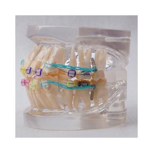 Dentale Ortodontico modello Con staffa di ceramica - Product Image 2