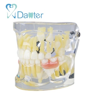 Modèle de dentisterie mixte, pour lumineux de dents manquantes, tétines primaire 1ère et 2ème génération, avec flipper, offre spéciale - Product Image 2