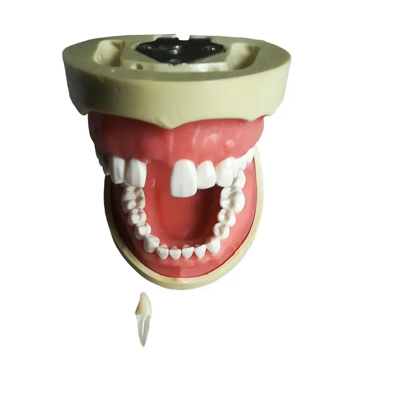 Produção de 32 modelos de preparação dente com um modelo dental de canal de raiz