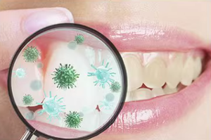 Gel Antiséptico Bucal Específico para Periodoncia, Material Plástico, 10 Unidades por Caja - Product Image 4