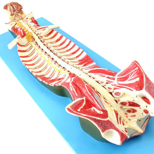 Anatomiemodel Van Het Menselijk Wervelkanaal Met Zenuwen In Het Ruggenmerg-Voor Anesthesie En Minimaal Invasieve Lumbaal Onderwijs - Product Image 1
