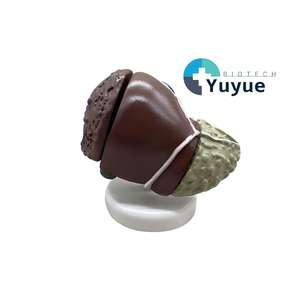 Modèle de Pathologie du Cancer du Foie avec Base - Spécimen Pédagogique d'Hépatologie - Product Image 1