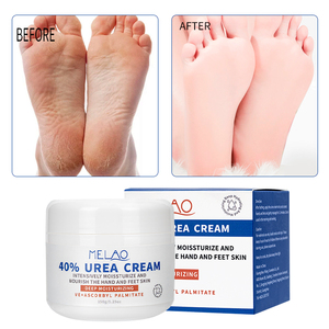 Crème Réparatrice Pieds Peaux Sèches Marque Blanche Hydratante Adoucissante Anti-Callosités aux Herbes 40% Urée Lotion Mains <span class=keywords><strong>Antifongique</strong></span> Soin de la Peau - Product Image 3