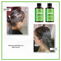 Aceite de Batana 100% Natural Puro y Crudo, Previene la Caída del Cabello, Aceite de Batana Sin Refinar que Mejora el Grosor, Aceite de Botana para el Crecimiento del Cabello