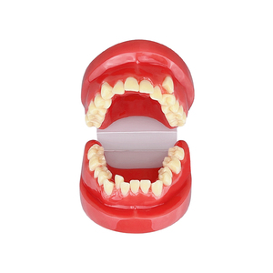 Modelo de Maloclusión Dental para Prácticas de Estudiantes de Odontología, Enseñanza, Entrenamiento, Comunicación, Equipo Médico Bucal - Product Image 6