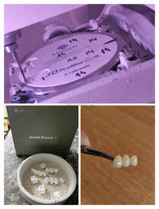 Prix fabricant Blocs de céramique dentaire en zircone colorée super translucide <span class=keywords><strong>STC</strong></span> 98*14 - Product Image 3