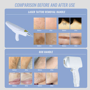 Appareil d'épilation <span class=keywords><strong>au</strong></span> <span class=keywords><strong>laser</strong></span> diode 2 en 1 808 nm 600 W, épilation des sourcils, équipement de beauté LS1282 - Product Image 5