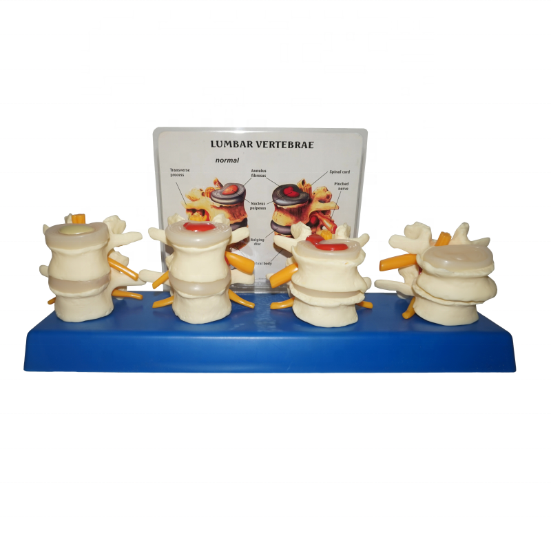 Модель каркаса R020704 для медицинской анатомии позвоночника, поясницы