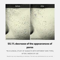 Crème visage Medicube Zero Pore One-Day, pores visiblement plus petits, contrôle du sébum, crème affinant les pores avec acide, et soin coréen pour la peau