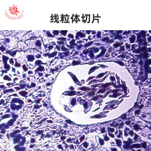 Mitosis de células animales (por ejemplo, huevos de lombrigas equinas); mitosis de puntas de raíz de plantas (objetivo microscópico) - Product Image 4