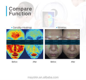 جهاز مرآة MC10 MEICET MEICET MC10 ، جهاز تجميل مرطب يتميز بخاصية توريد المصنع مباشرة - Product Image 6