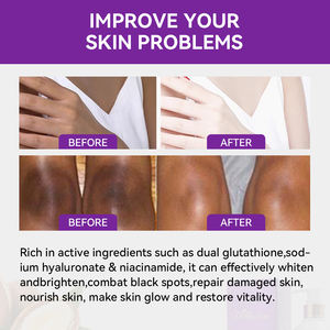 د. روسيفا علامة تجارية خاصة لوشن جسم عضوي مغذي للوجه مخفوق مرطب زبدة الشيا مرطبة - Product Image 4