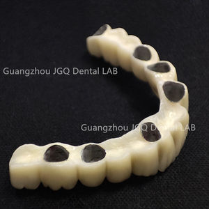 Metallo ceramico dentiere produttore di prodotti dentali Custom Pfm corone ponti con rosa gomma porcellana - Product Image 4