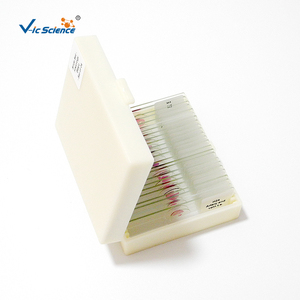 กบตัวอ่อนเตรียมกล้องจุลทรรศน์สไลด์28<span class=keywords><strong>รายการ</strong></span>กล้องจุลทรรศน์ทางชีววิทยาเพื่อการศึกษาภาพนิ่งกบการพัฒนาตัวอ่อน - Product Image 1