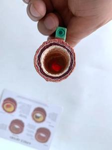 Modelo de aterosclerosis de la arteria humana-Herramienta de demostración de enfermedad vascular anatómica para enseñanza médica y entrenamiento de estudiantes - Product Image 5