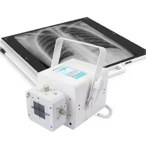 เครื่องเอกซเรย์เอกซ์เรย์พลังงานสูงสำหรับอุปกรณ์เอกซ์เรย์แบบพกพาสำหรับศัลยกรรมกระดูกระบบการถ่ายภาพรังสีดิจิตอล DR <span class=keywords><strong>X</strong></span> <span class=keywords><strong>ray</strong></span> - Product Image 3