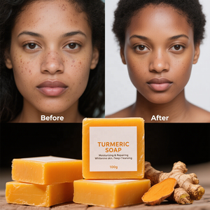 Jabón de limón de cúrcuma hecho a mano de etiqueta privada con jabón corporal hidratante blanqueador de Ácido Kójico - Product Image 3