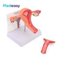 Modelo de anatomía del útero y ovario femenino Medeasy, modelo de útero normal y con enfermedades, con base desmontable para la enseñanza de enfermería médica