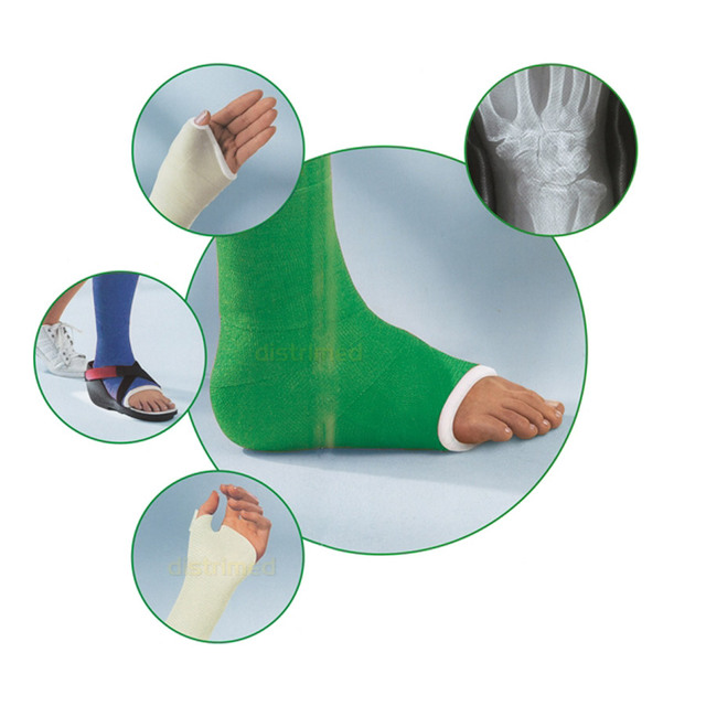 Waterproof Orthopedic Fiberglass Casting Tape Water Activated Synthetic Fiberglass Casts for Surgical Use