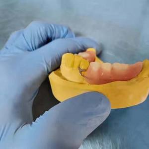 Materiali Ortodontici Clinici Dentali, Filo in Acciaio Inossidabile, Fermagli Roach Dentali per Protesi Parziali in Acrilico - Product Image 3