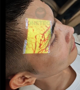 Fillter and IV Vessel <strong>Viewer</strong> VF12 Ergonomic Design High Technology Portable Vein Finder Locator with Promotional Price - Product Image 3