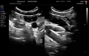 Échographe vétérinaire portable pour clinique hospitalière, fabrication <span class=keywords><strong>d</strong></span>'échographes, échocardiographe 3D couleur Doppler - Product Image 5
