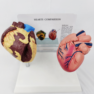 Modelo de Patología del Corazón Humano para Ciencias Médicas, Modelo de Enfermedades Orgánicas, Modelo Antidrogas - Product Image 3
