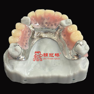 Prothèses dentaires amovibles avec cadre métallique imprimé <span class=keywords><strong>en</strong></span> 3D par laser, fabriquées <span class=keywords><strong>en</strong></span> Chine, laboratoire dentaire, <span class=keywords><strong>prix</strong></span> d'usine - Product Image 3