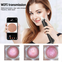 Aspirateur anti-points noirs avec caméra pour le nez et le visage, étanche, portable, prise US