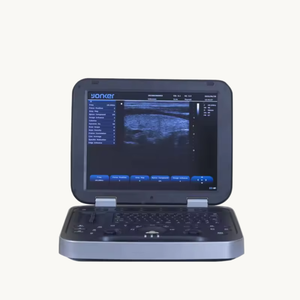 Fitin Fluxo sanguíneo cardíaco e renal médico Máquina portátil do ultrassom da cor doppler do ultrassom do varredor do ultrasonido do portátil - Product Image 4