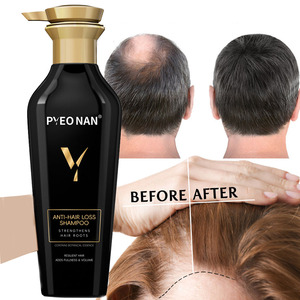 Champú Antibacteriano <span class=keywords><strong>de</strong></span> Marca Privada <span class=keywords><strong>de</strong></span> Fábrica <span class=keywords><strong>para</strong></span> el Crecimiento del <span class=keywords><strong>Cabello</strong></span> y Contra la Caída del <span class=keywords><strong>Cabello</strong></span>, Champú Anticaspa y Anticaída - Product Image 3