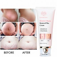 Crème Bio au Beurre de Karité Fermenté et Vitamine E pour l'Élimination des Cicatrices Corporelles, Lissante, Raffermissante et Anti-Vergetures Post-partum