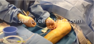 980 laser endovenoso EVLT 1470nm irradiazione endovenosa sangue varicosa vascolare ragno vena laser rimozione vene varicose dispositivo vene varicose - Product Image 4