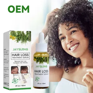 Chinaherbs 7 dias orgânico alecrim óleo de crescimento do cabelo para as mulheres negras private label ervas perda de cabelo soro