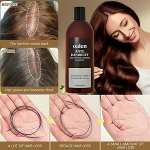 Shampoo Antiforfora al <span class=keywords><strong>Solfuro</strong></span> <span class=keywords><strong>di</strong></span> <span class=keywords><strong>Selenio</strong></span> 1% a Marchio Privato con 11 Estratti Botanici per il Controllo della Caduta dei Capelli e il Trattamento del Cuoio Capelluto Pruriginoso - Product Image 4