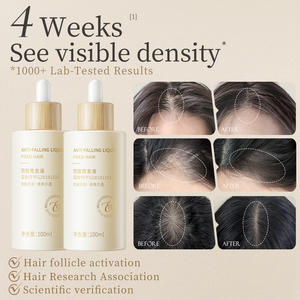 100ml Fast <strong>Hair</strong> Growth Oil Repair <strong>Hair</strong> Scalp Care Anti <strong>Hair</strong> <strong>Loss</strong> <strong>Treatment</strong> Herbal Regrowth Thicken Serum Essence Liquid - Product Image 2