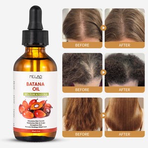 Huile de Batana pour la croissance naturelle des cheveux, stock Honduras, beurre de Batana, huile de croissance, nourrit, réduit la perte de cheveux, anti-casse, produits de soin des cheveux - Product Image 3