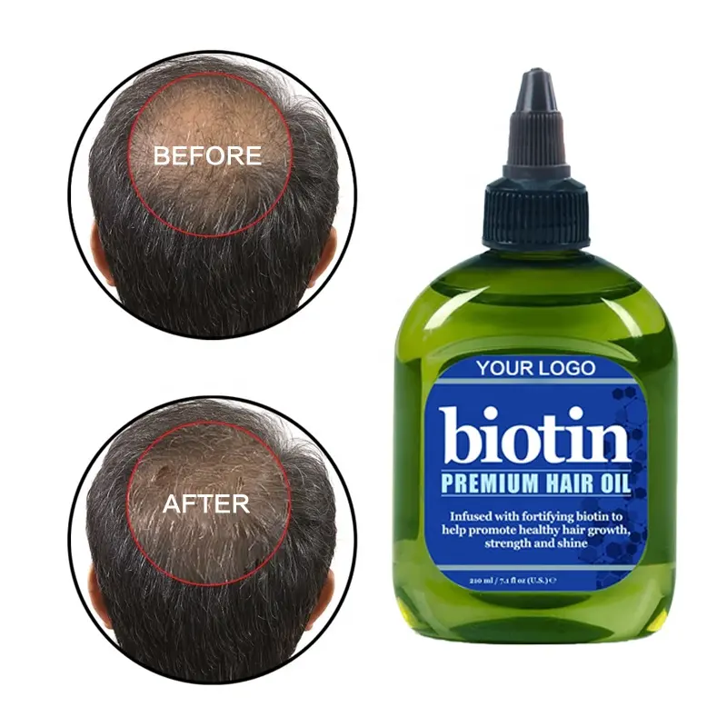 Best Verkopende 30 Dagen Mannen Haaruitval Behandeling Natuurlijke Biotine Haarolie Voorkomen Hoofdhuid Verlies Hergroei Olie Serum