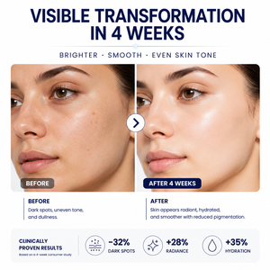 <span class=keywords><strong>Crema</strong></span> Correttiva per Macchie Scure su <span class=keywords><strong>Viso</strong></span> e Corpo, per Macchie dell'Età, Macchie Solari, Melasma, Lentiggini, Corregge Rapidamente il Tono della Pelle Non Uniforme - Product Image 6