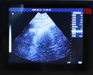 Escáner de Embarazo y Enfermedades Uterinas Portátil M10, Máquina de Ultrasonido Veterinaria Portátil - Product Image 5