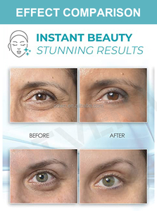 OEM ODM – crème pour les yeux, élimination des cernes sous les yeux, marque privée - Product Image 5