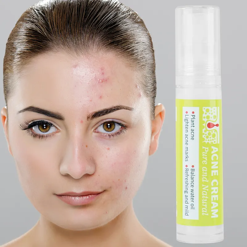 FATAZEN Custom Logo Skin Care Organic Natural Acne Cream With Aloe Vera Gel Anti Acne Removal Moisturizing Treatment Cream