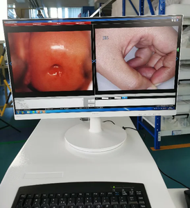 コルポスコープ垂直スタンド付きカーネルKN-2200高品位デジタルビデオコルポスコープ - Product Image 3