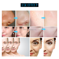 9-in-1 professionele gezichtsreinigingsmachine met aqua peeling zuurstofbelletjes voor huidverjonging en huidversteviging