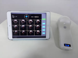 Scanner de lame sans fil <span class=keywords><strong>Portable</strong></span> Apple iOS Android, outil de diagnostic de voiture, livraison gratuite, mllpu37 - Product Image 3