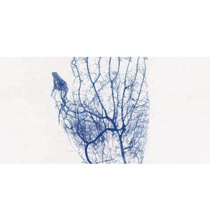 BIOBASE cina J laboratorio portatile vena Finder macchina BK-VIA100 sangue portatile Finder vena per laboratorio per ospedale - Product Image 2