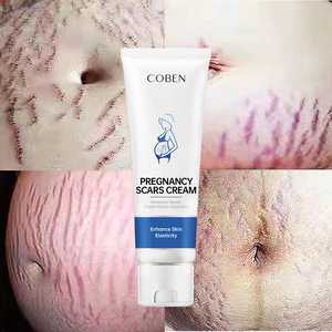 Oem/odm ครีมให้ความชุ่มชื้นแก่ร่างกายจากธรรมชาติบริสุทธิ์ลบรอยแผลเป็น ครีมยืดรอยธรรมชาติสําหรับผิว - Product Image 1